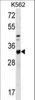 TIPRL / TIP Antibody (aa189-218)