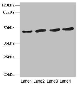 Polyclonal Rabbit anti-Human RASSF5 / RAPL Antibody (IHC, WB)