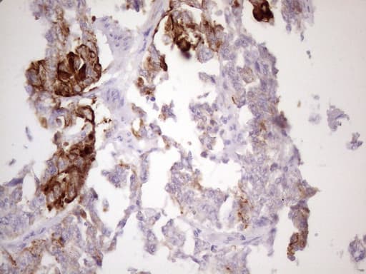 KRT16 / CK16 / Cytokeratin 16 Antibody (clone 7A4, Carrier-free)