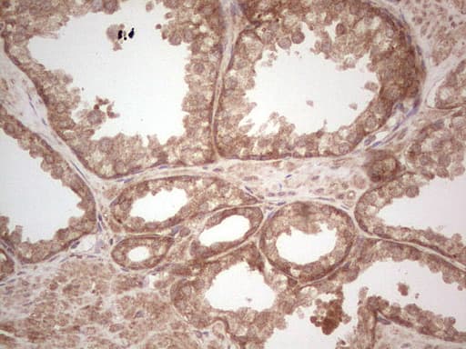 UBE2D2 / UBCH5B Antibody (clone OTI2C2)