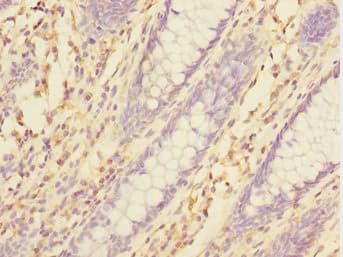 Polyclonal Rabbit anti-Human TXNDC5 / ERP46 Antibody (IHC, WB)