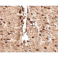 MEX3D Antibody