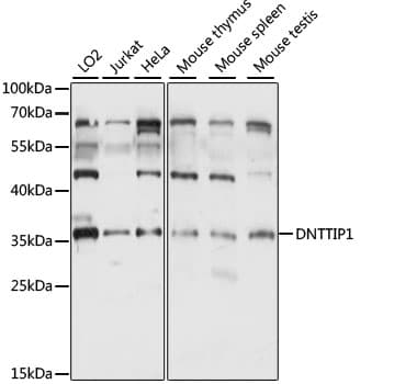 DNTTIP1 / TDIF1 Antibody