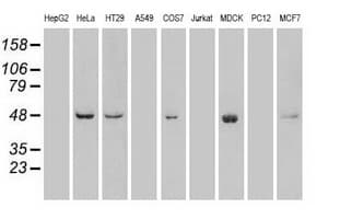 PLK1 / PLK-1 Antibody (clone OTI8C12)