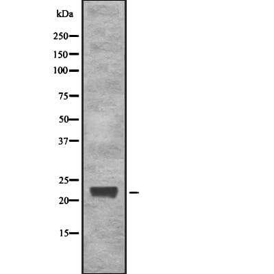 IGLL1 / CD179b Antibody