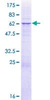 Human NDUFAF1 / CIA30 Protein (Recombinant GST)