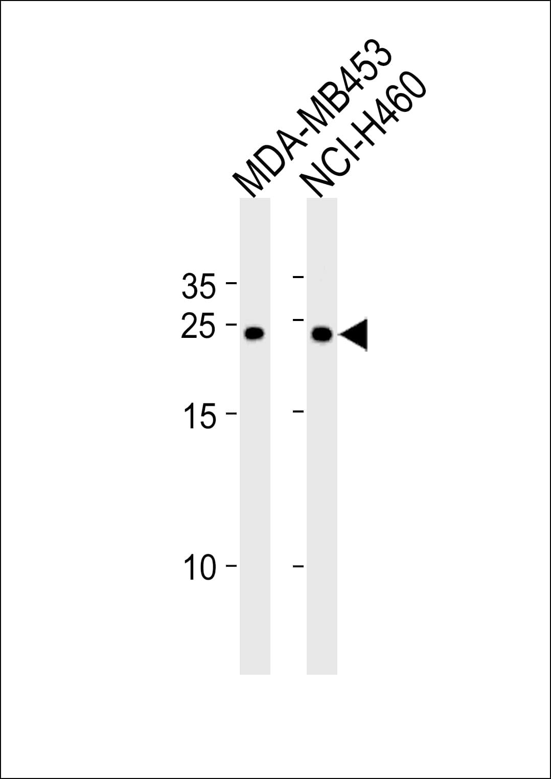 BCAP31 / BAP31 Antibody (aa120-147)