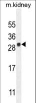 LYPD4 Antibody (aa104-133)