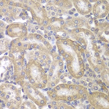 KRT17 / CK17 / Cytokeratin 17 Antibody