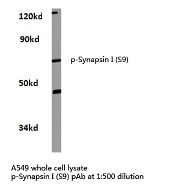 SYN1 / Synapsin 1 Antibody (phospho-Ser9)