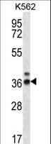 RPP38 Antibody (aa248-277)
