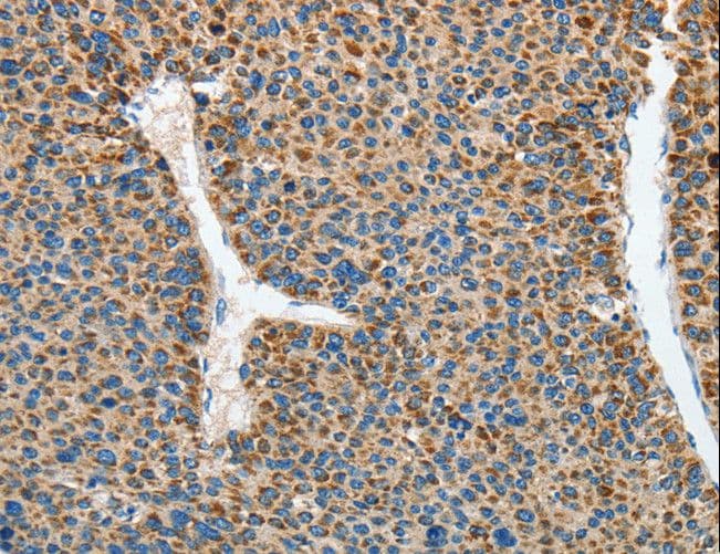RCAN1 / DSCR1 Antibody