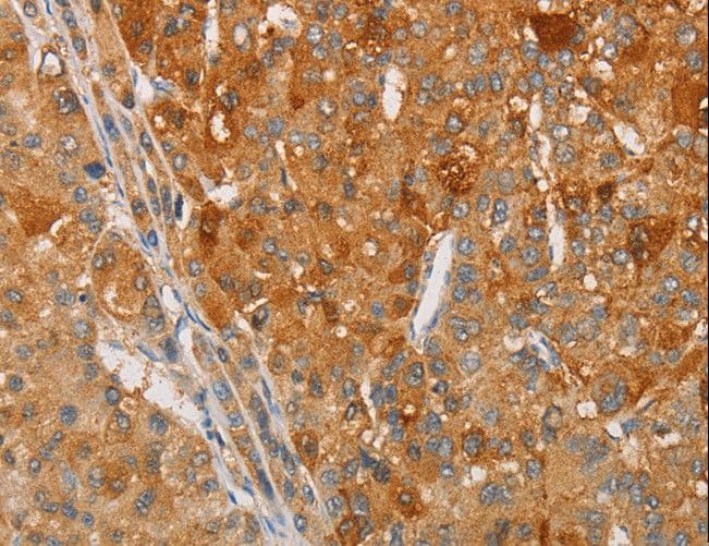 ARSG / Arylsulfatase G Antibody