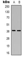 Polyclonal Rabbit anti-Human CD84 / SLAMF5 Antibody (Internal, WB)