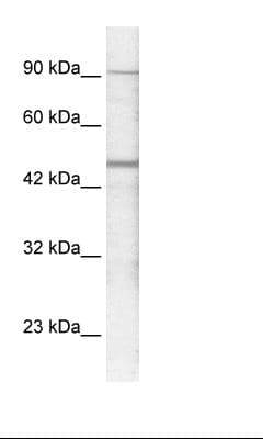 GABRP Antibody (aa28-77)