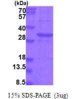 Human KLK13 / Kallikrein 13 Protein (Recombinant His)