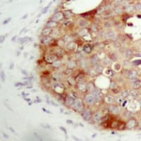 FAP Alpha Antibody (Internal)