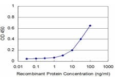 RAB17 Antibody (clone 2A10)