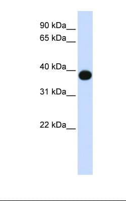 DEGS1 Antibody (N-Terminus)