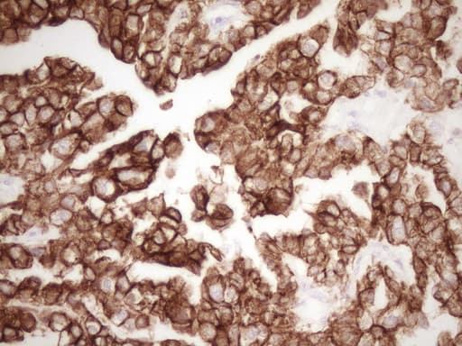 Monoclonal Mouse anti-Human KRT19 / CK19 / Cytokeratin 19 Antibody (clone OTI6A8, aa240-390, IHC, WB)