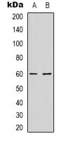 NXF3 Antibody (Internal)