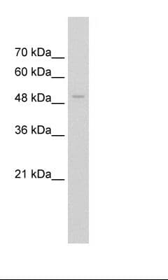 Polyclonal Rabbit anti-Human FAM174B Antibody (N-Terminus, IHC, WB)