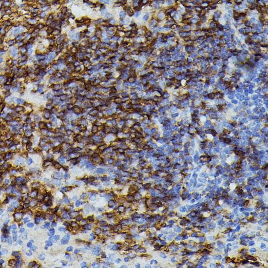 APOC3 / Apolipoprotein C III Antibody