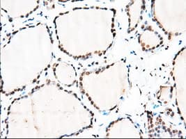 HMRF1L / MTRF1L Antibody (clone OTI2B5)