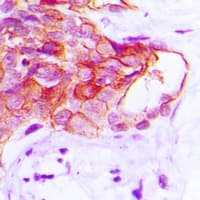 Polyclonal Rabbit anti-Human CADM2 Antibody (Internal, IHC, IF, WB)