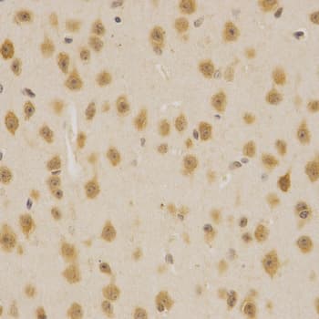 MDM2 Antibody