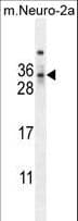 Polyclonal Rabbit anti-Human MAF1 Antibody (aa90-117, IHC, WB)