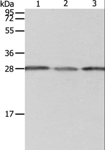 Polyclonal Rabbit anti-Human PSMD9 / 26S Proteasome Antibody (IHC, WB)
