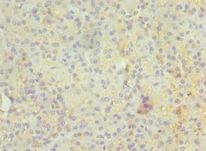 RAB4A / RAB4 Antibody (aa1-218)