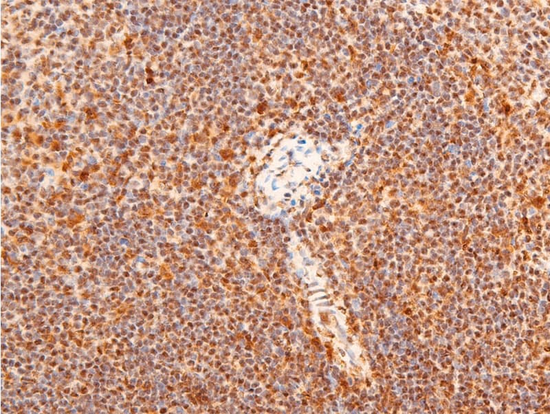 Polyclonal Rabbit anti-Human JUN / c-Jun Antibody (phospho-Thr91, IHC, WB)