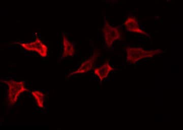Polyclonal Rabbit anti-Human PTPRN2 / Phogrin Antibody (IF, WB)