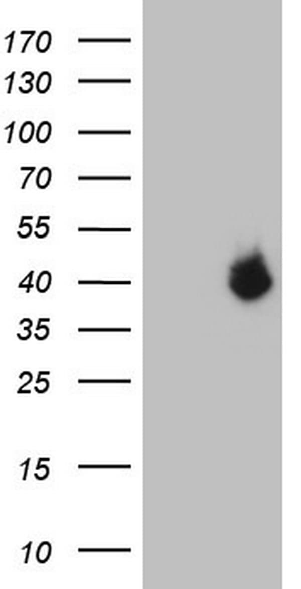Monoclonal Mouse anti-Human PAGE1 Antibody (clone OTI3D7, WB)