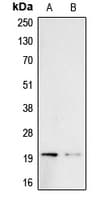 BTC / Betacellulin Antibody (Internal)