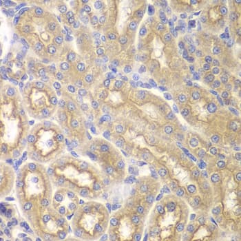 IL12RB1 / CD212 Antibody