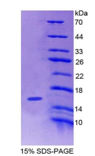 Human VPREB1 / CD179A Protein (Recombinant His-T7)