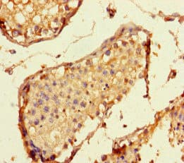 HSpc24 / SPBC24 Antibody