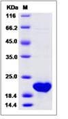 Mouse OSM / Oncostatin M Protein (Recombinant)