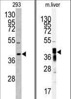 AKR7A2 / AFAR Antibody (aa101-129)