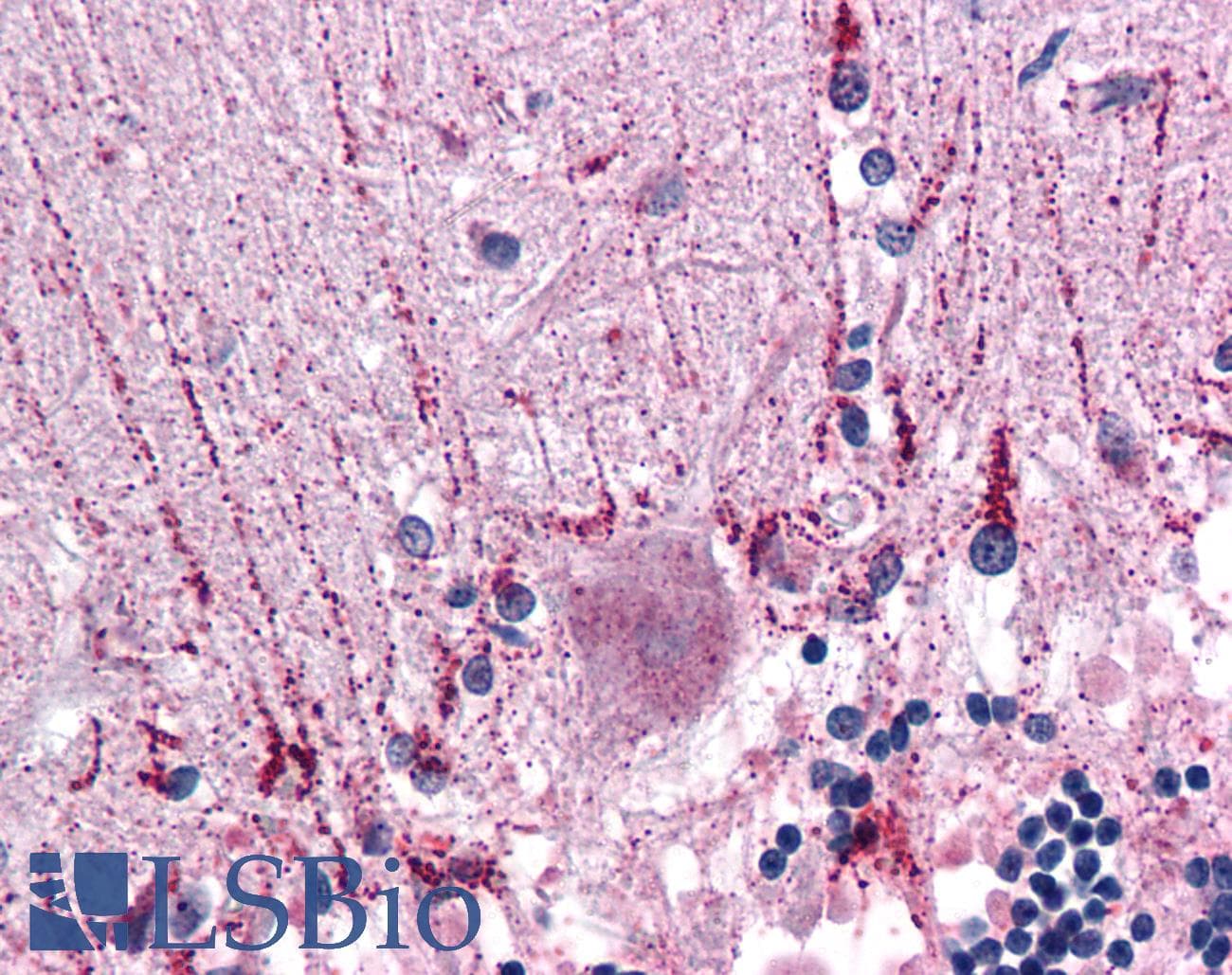 IHC-plus™ CYP26B1 Antibody