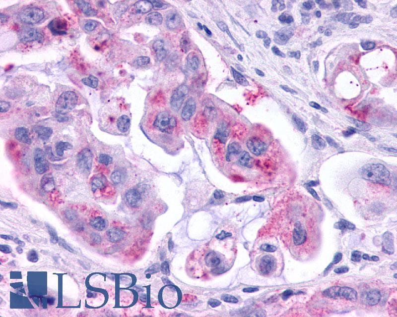 PathPlus™ KISS1R / GPR54 Antibody (N-Terminus)