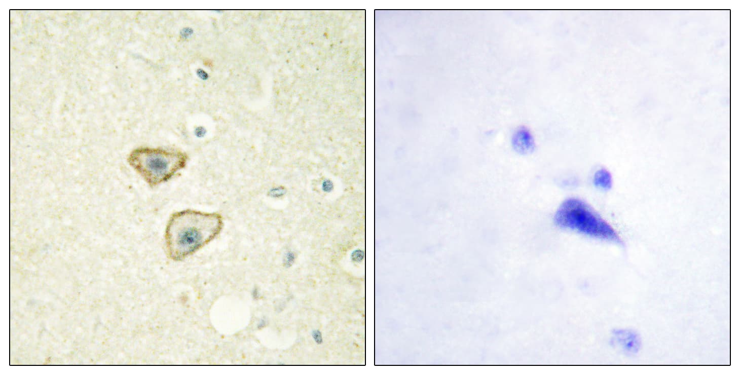 EGFR Antibody (aa986-1035)