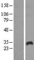 Human PAGE1 Protein (Over-Expression Lysate Myc-DDK (Flag))