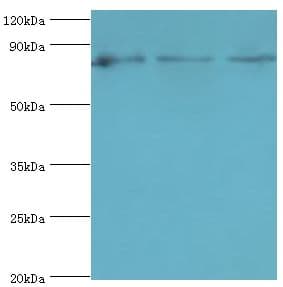 DVL2 / Dishevelled 2 Antibody (aa1-240)