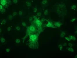 PNMT Antibody (clone OTI4F1)