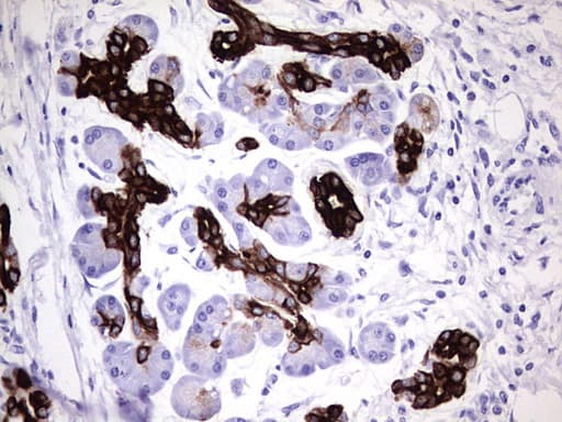 KRT7 / CK7 / Cytokeratin 7 Antibody (aa1-114, clone UMAB161)