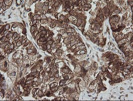 ROMO1 Antibody (clone OTI2C12)